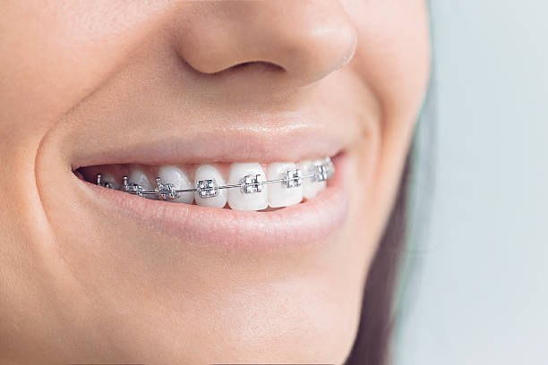 Best TMJ/TMD Treatment  in Spring Ridge, MD